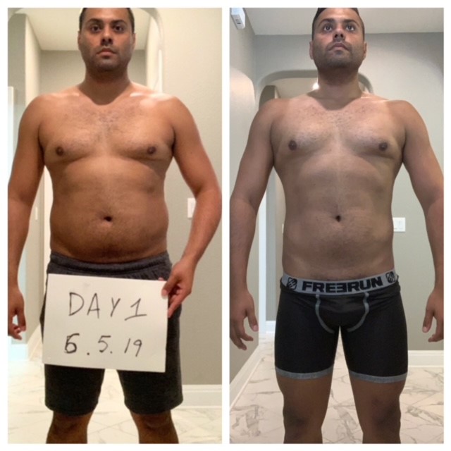 Gynecomastia Success