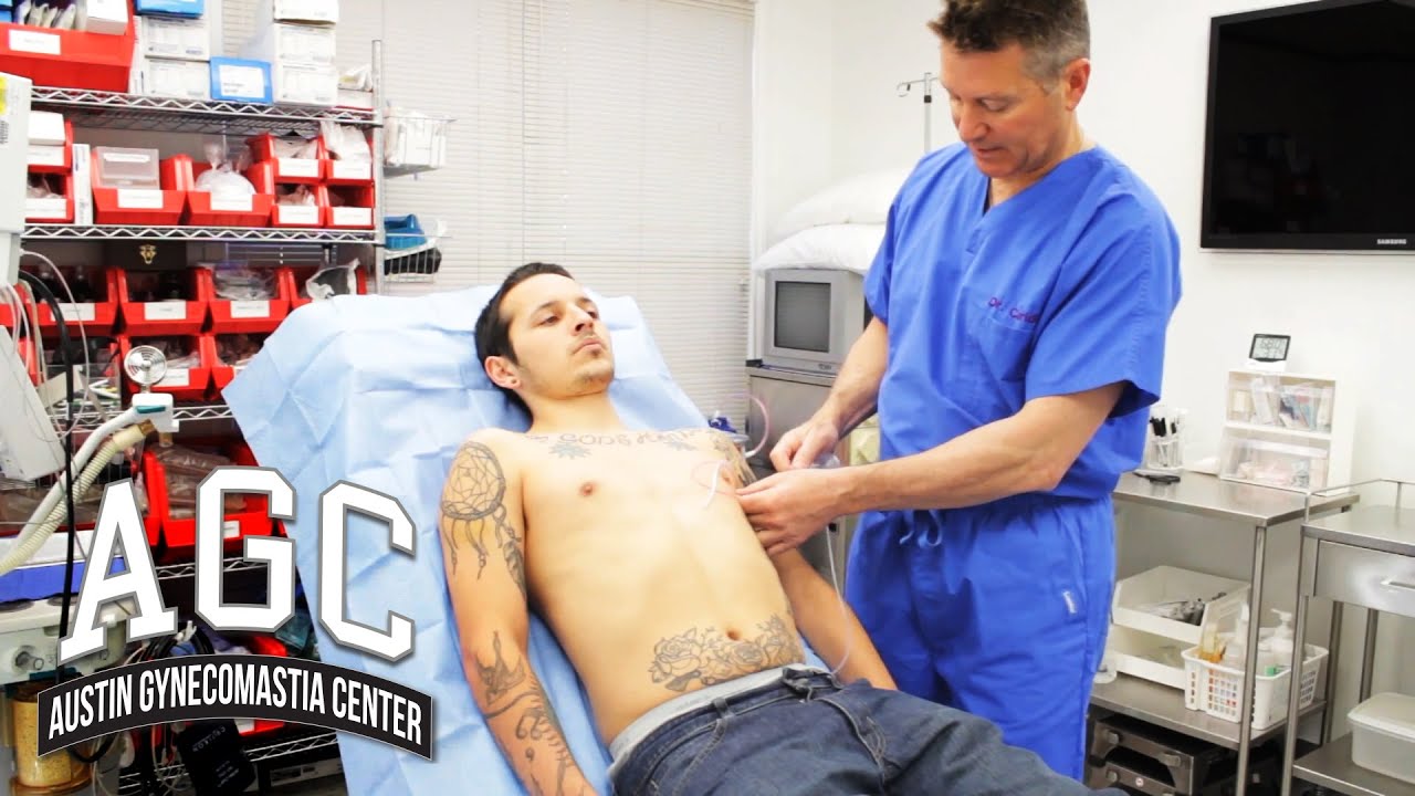 Surgical drain for Gynecomastia recovery video