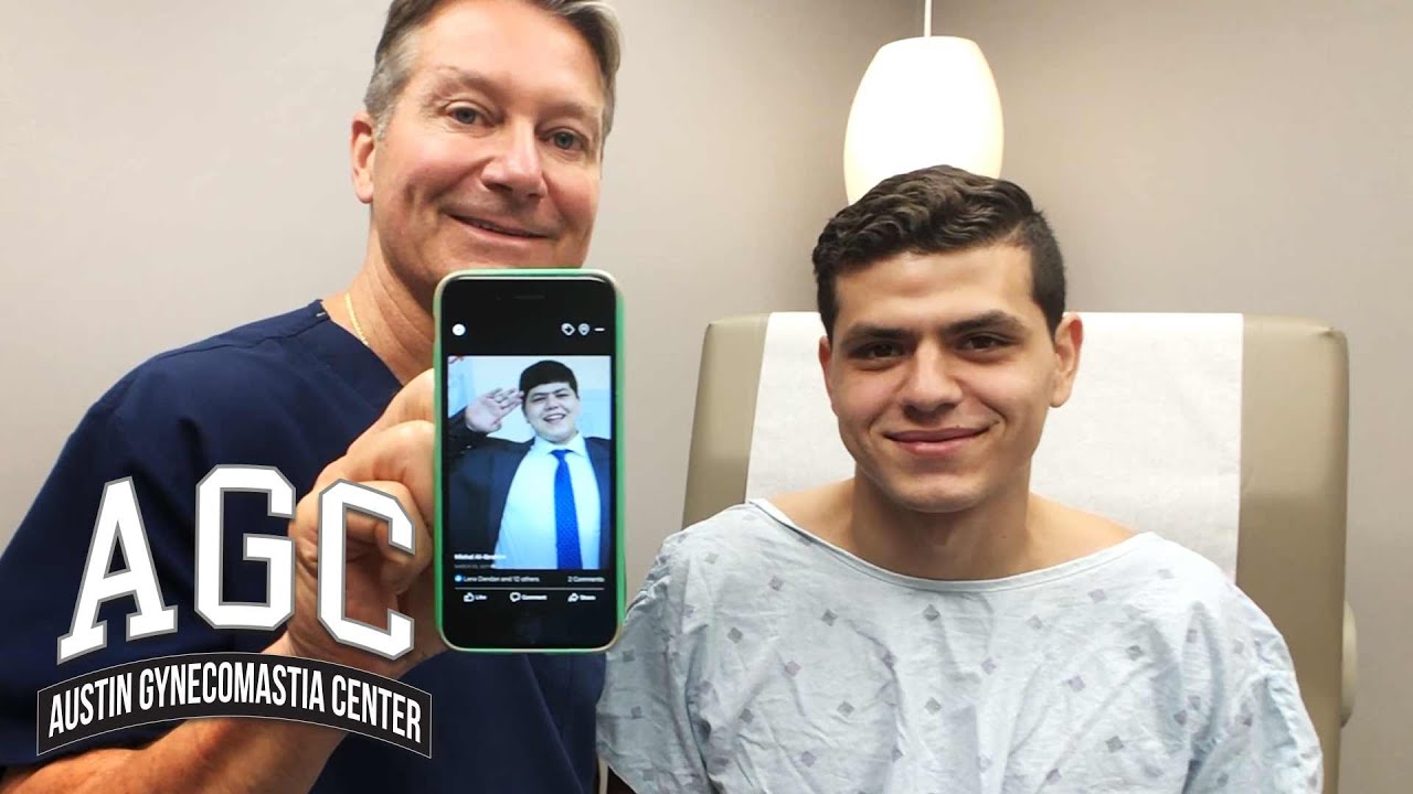 Dr. Caridi with happy Gynecomastia patient video