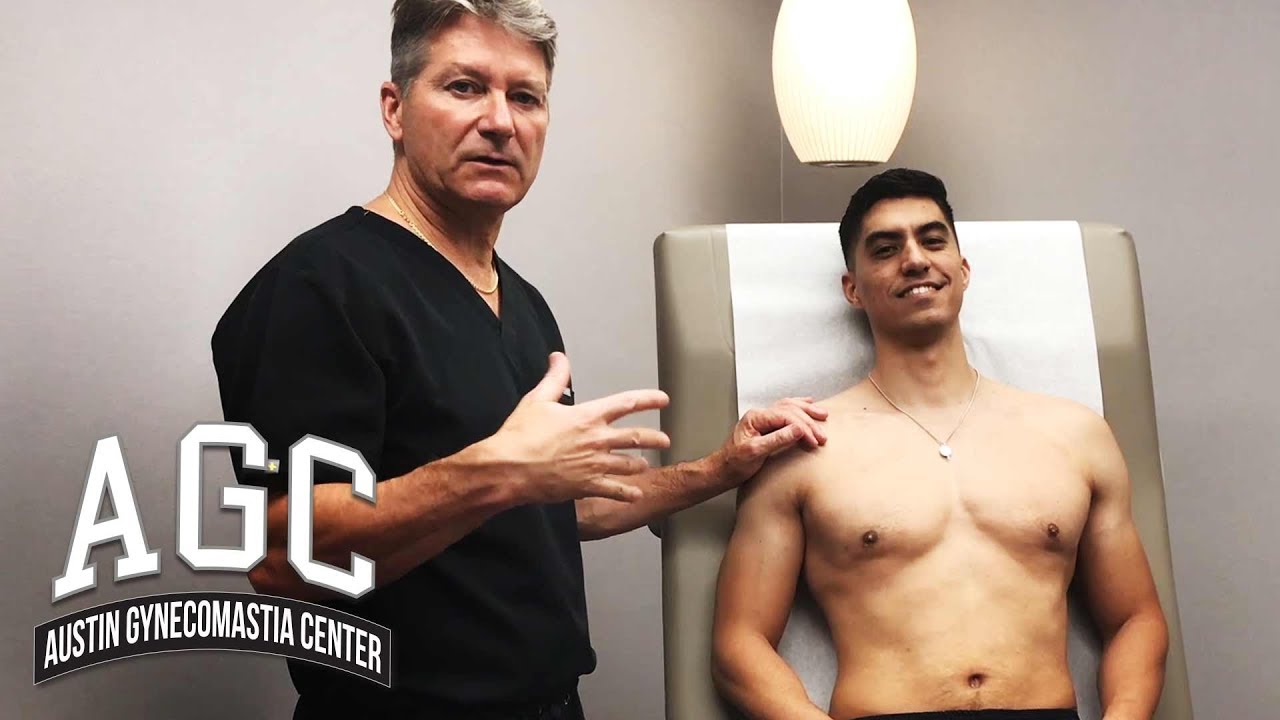 Dr. Caridi with Austin Gynecomastia surgery patient video
