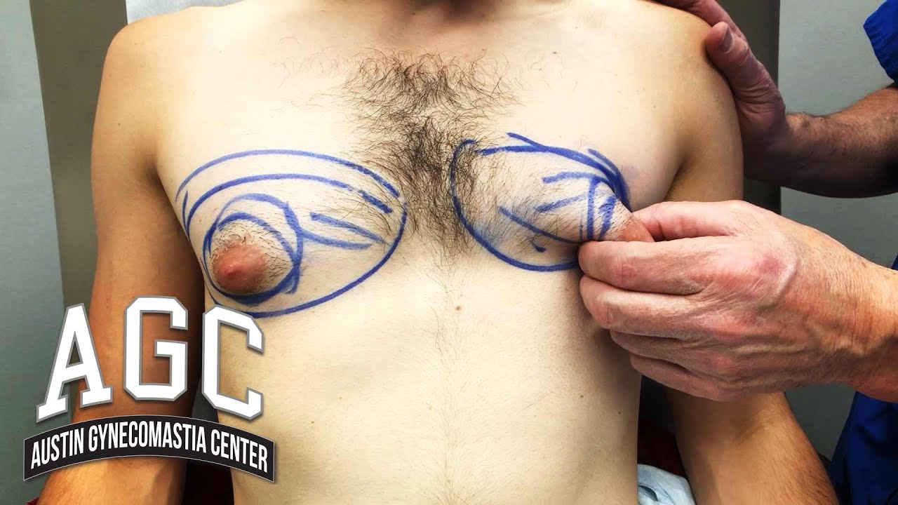 AGC male chest assessment video